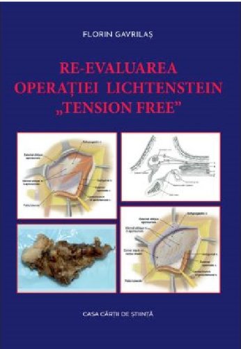 Re-evaluarea operatiei lichtenstein „tension free” | florin gavrilas