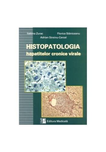 Histopatologia hepatitelor virale